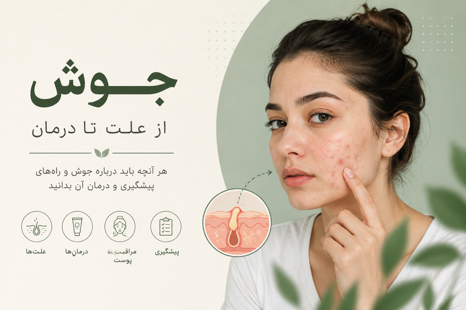 علت جوش صورت چیست؟ بررسی دلایل جوش و راه‌های مراقبت از پوست