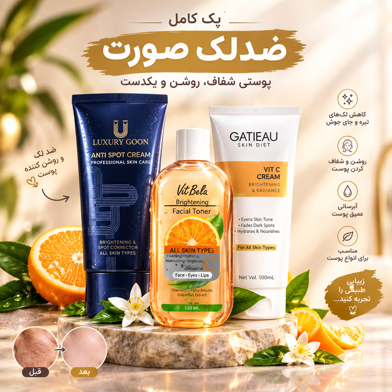 قویترین پک ضدلک فرانسوی اصل لاکچری