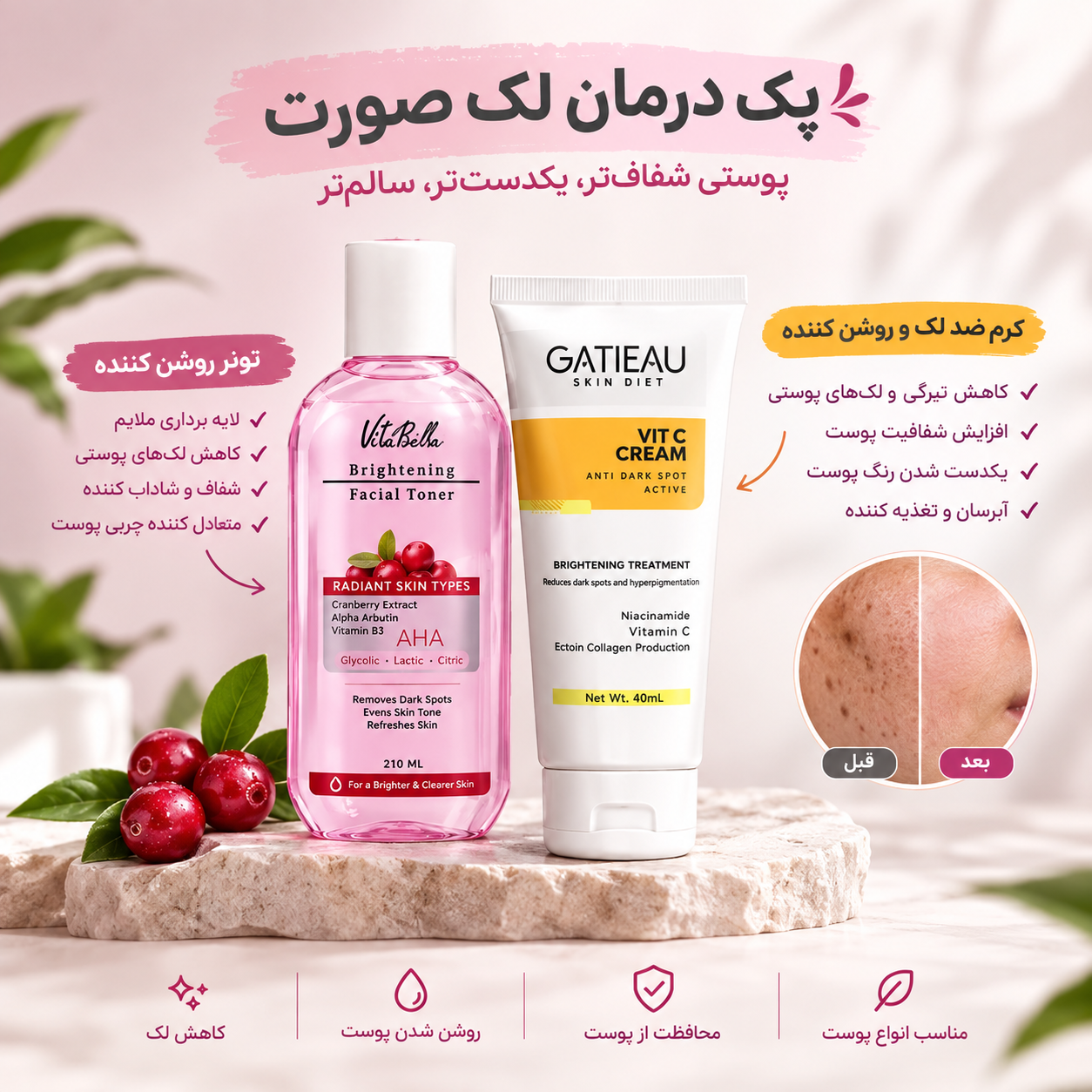 پک ضد لک صورت و روشن کننده پوست شامل تونر ویتابلا و کرم ویتامین C گاتیو